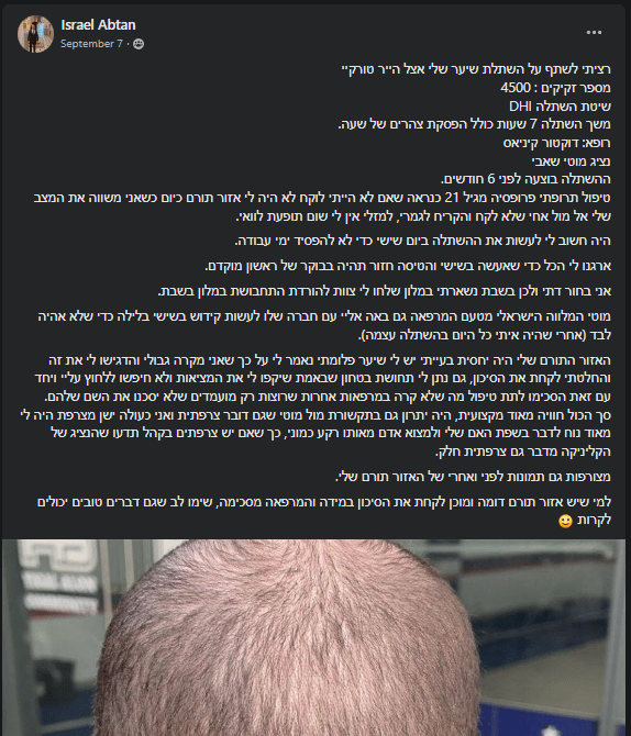 המלצה של ישראל אבטן על השתלת שיער בטורקיה מסוג DHI עם הייר טורקיי